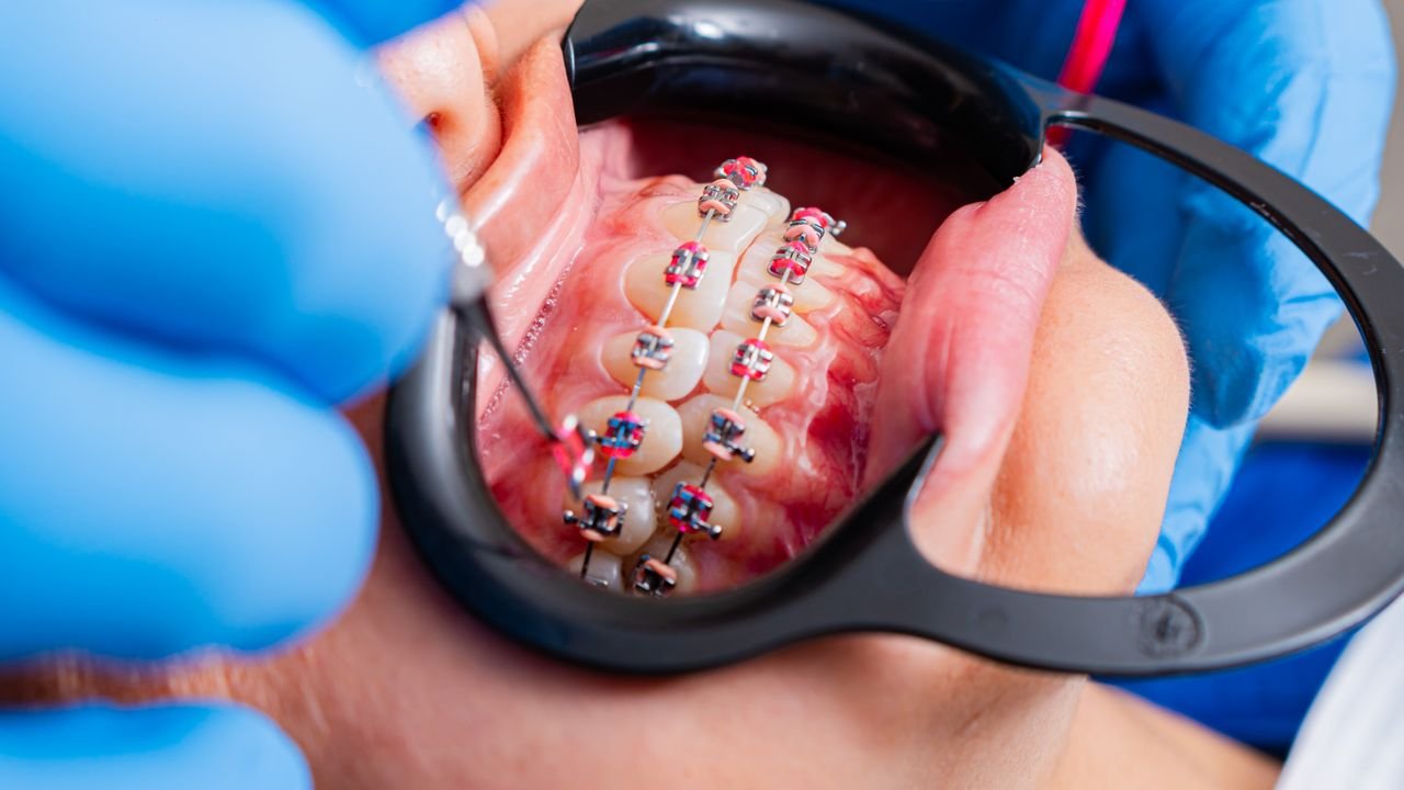 orthodontics2