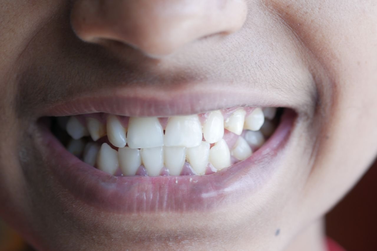 Prosthodontic3